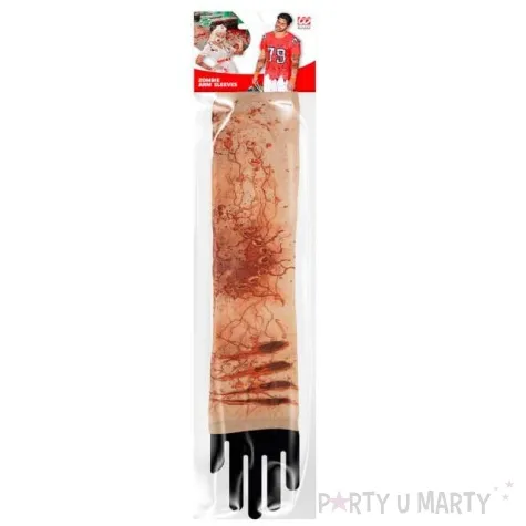 rekawy poranione rece czerwone widmann