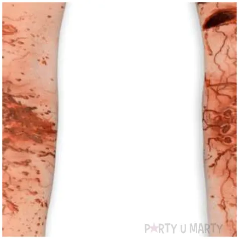 rekawy poranione rece czerwone widmann