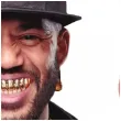 xx gold teeth adult